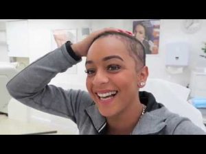 Paigey Cakey – I Got PRP Hair Growth Therapy
