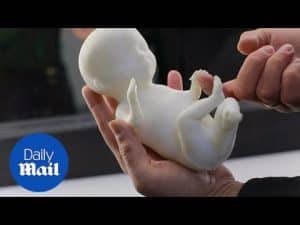 Russian mother receives 3D model of her unborn baby after scan – Daily Mail