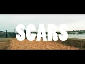T – STACKS –  HOOD SCARS/INTRO | #OSMVision
