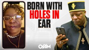 People Born With Holes In Their Ear | SUBMIT 3 QUESTIONS