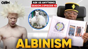 Albino – What is Albinism?